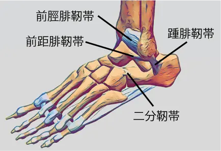 捻挫画像
