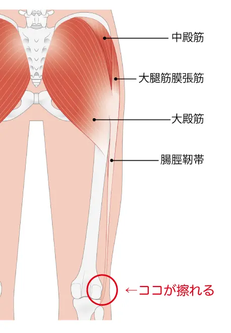 ランナー膝画像