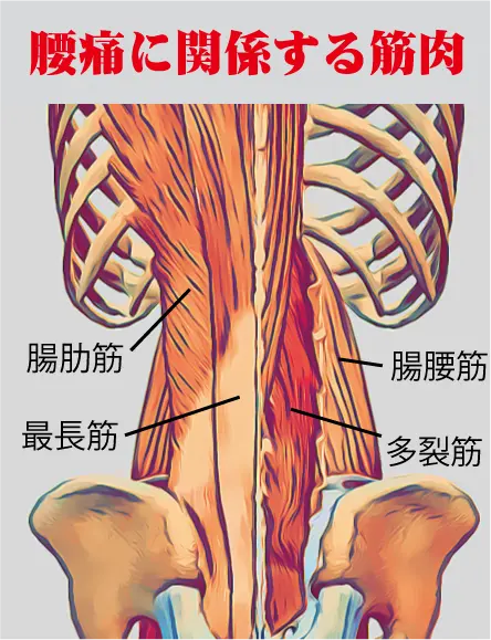 腰痛画像2