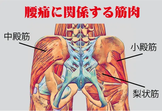 腰痛画像3